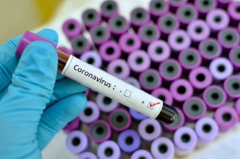  Coronavirus infections jump to 4 in Herat
